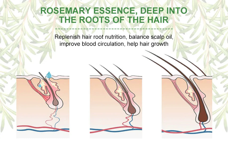 Aceite Esencial De Romero Para El Crecimiento Del Cabello 2x1 ✨