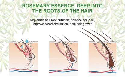 Aceite Esencial De Romero Para El Crecimiento Del Cabello 2x1 ✨