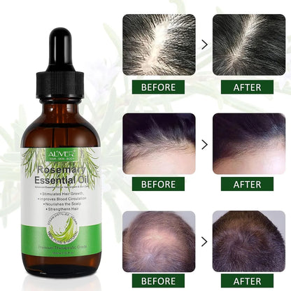 Aceite Esencial De Romero Para El Crecimiento Del Cabello 2x1 ✨